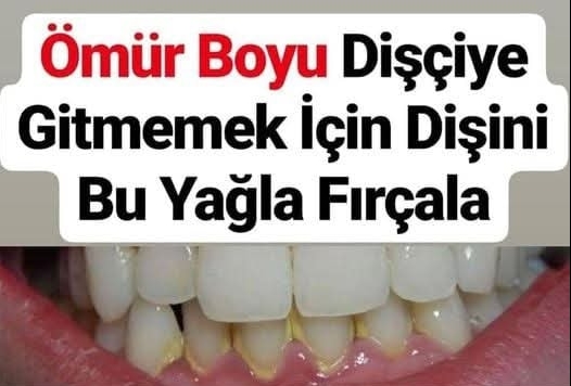 Diş eti çekilmesine bitkisel tedavi yöntemleri